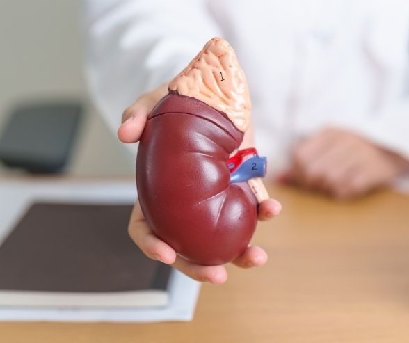 ÜRİNER SİSTEM TAŞ HASTALIĞI