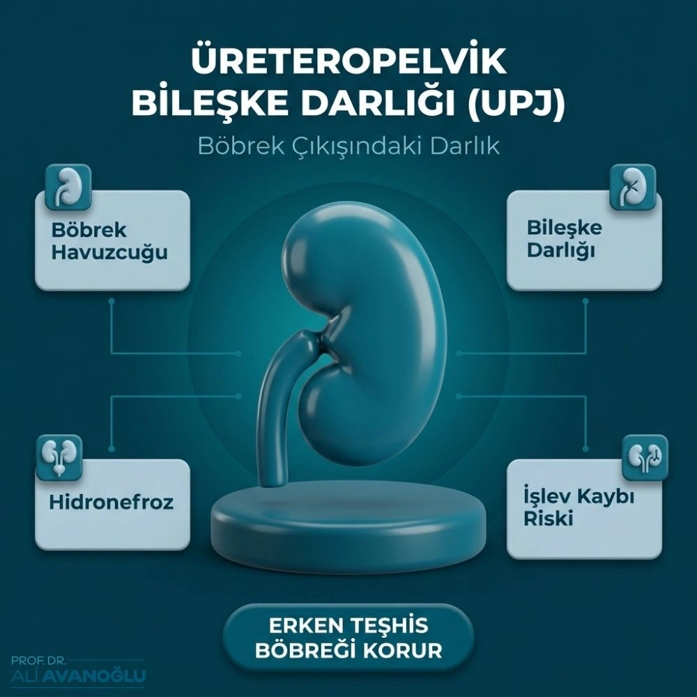 pyeloplasti ne demek