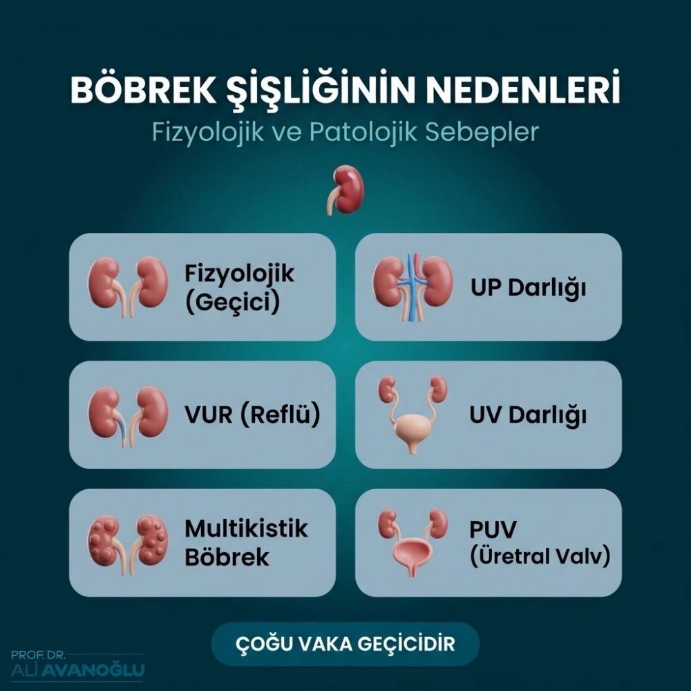 Böbrek Genişlemesi