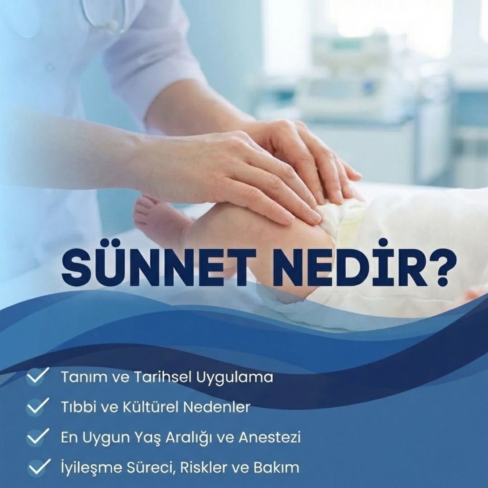 Sunnet--nedir