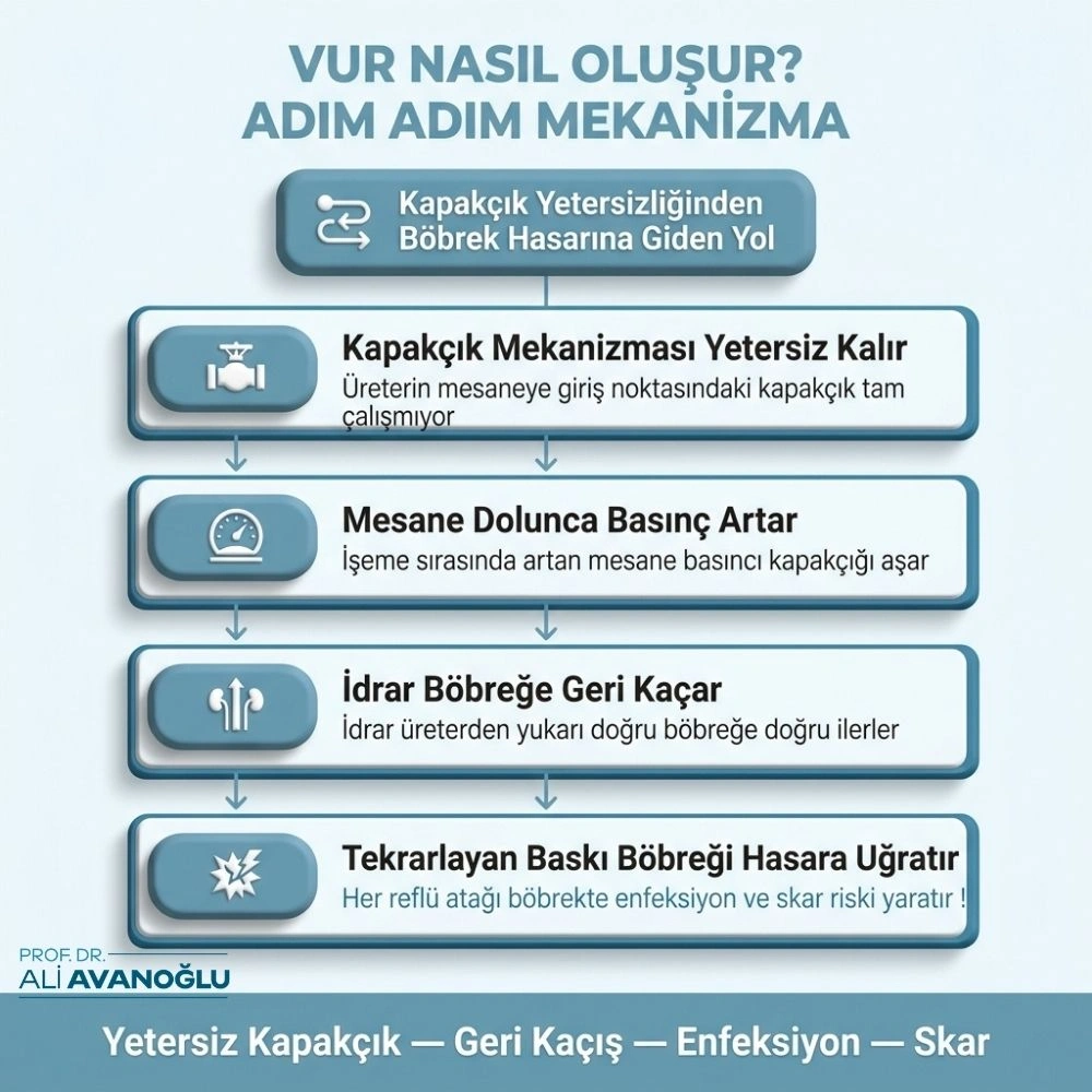 vezikoüreteral reflü tedavisi