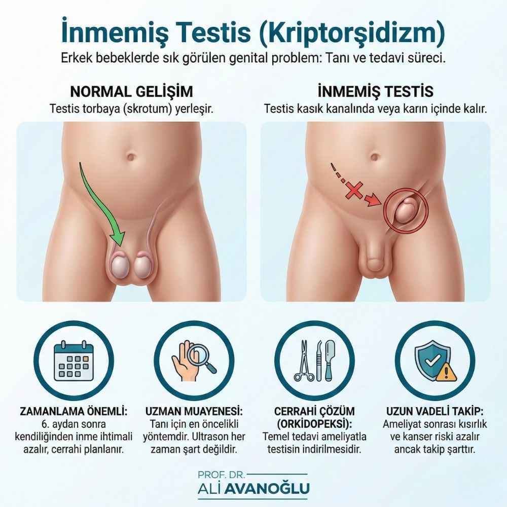Inmemis-Testis