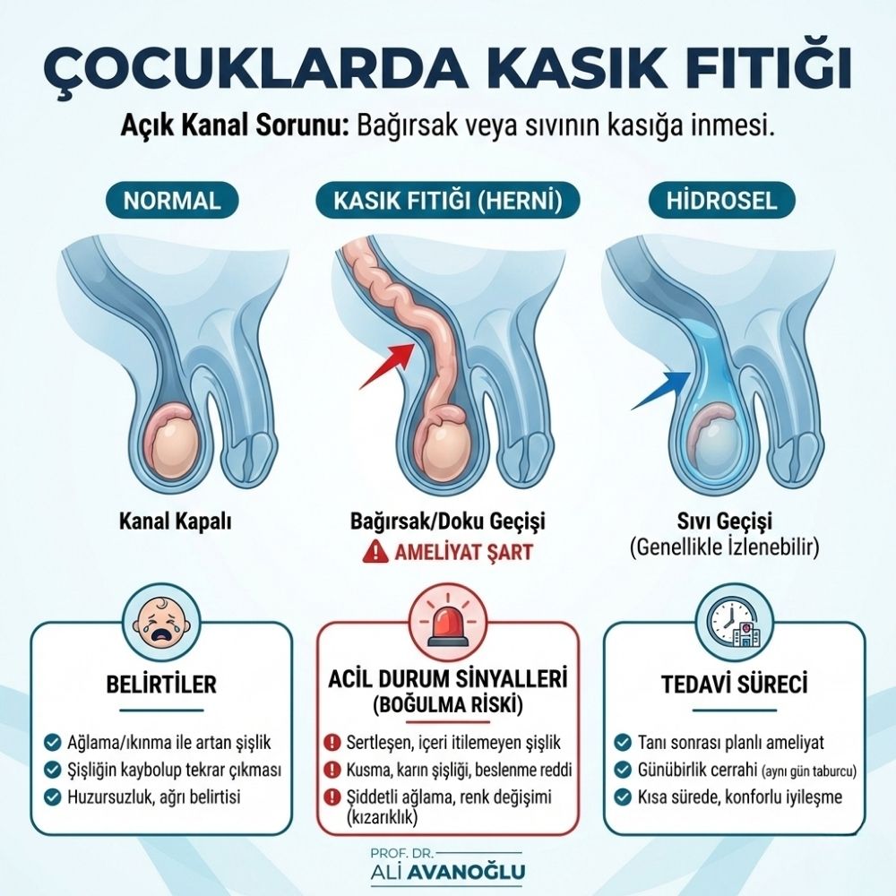 Cocuklarda-Kasık-Fıtıgı
