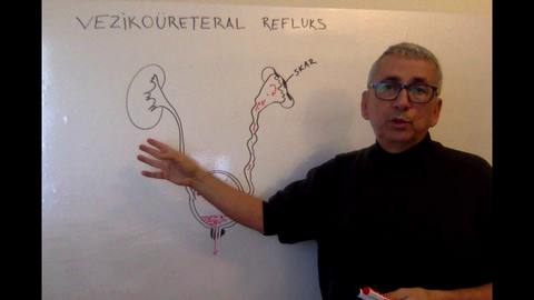 Vezikoüreteral reflüks
